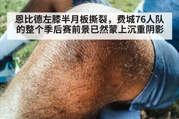 恩比德左膝半月板撕裂，费城76人队的整个季后赛前景已然蒙上沉重阴影